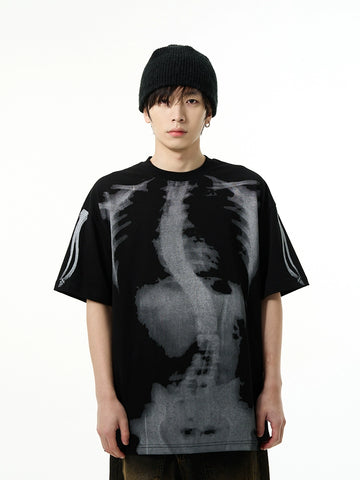 77Fight X-ray Tee